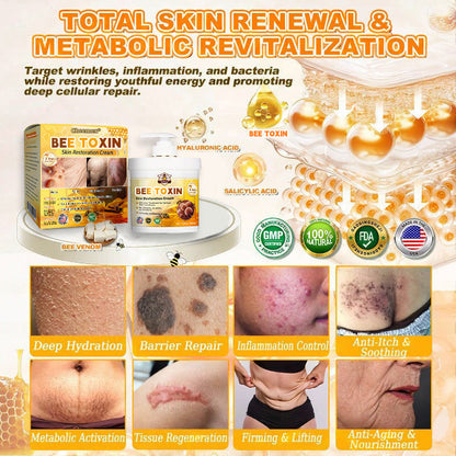 🐝🔥FDA Approved|Cheemex® Bee Venom Skin Restoration Cream (Anti-aging. Hydrating. Skin Repair. Even Tone. Acne and Dark Spot Treatment. Wart and Mole Removal. Psoriasis Relief)