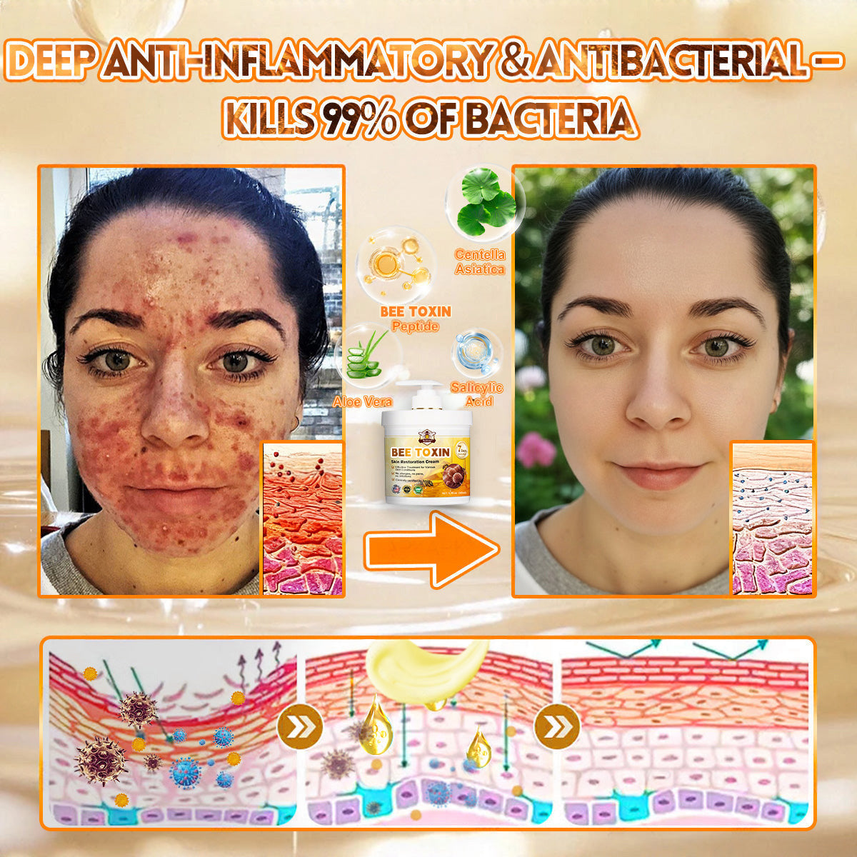 🐝🔥FDA Approved|Cheemex® Bee Venom Skin Restoration Cream (Anti-aging. Hydrating. Skin Repair. Even Tone. Acne and Dark Spot Treatment. Wart and Mole Removal. Psoriasis Relief)