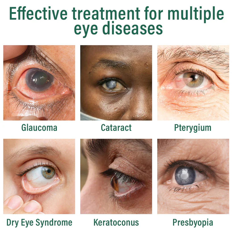 Nexisify® Nano Eye Drops Serum ✅FDA Approved(Suitable for presbyopia. dry eye syndrome. glaucoma. and cataracts) ☘️☘️