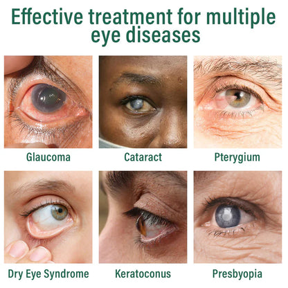 Nexisify® Nano Eye Drops Serum ✅FDA Approved(Suitable for presbyopia. dry eye syndrome. glaucoma. and cataracts) ☘️☘️