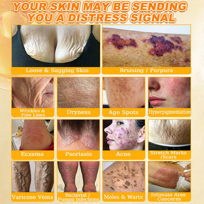 🐝🔥FDA Approved|Cheemex® Bee Venom Skin Restoration Cream (Anti-aging. Hydrating. Skin Repair. Even Tone. Acne and Dark Spot Treatment. Wart and Mole Removal. Psoriasis Relief)