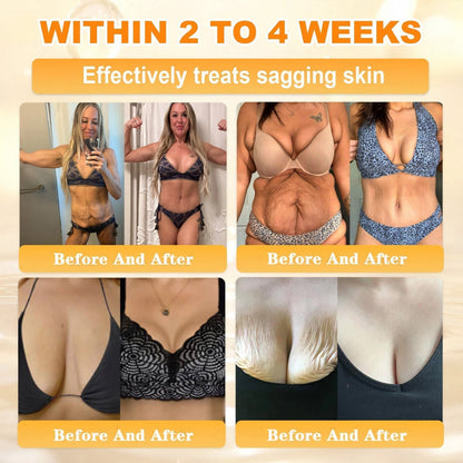 🐝🔥FDA Approved|Cheemex® Bee Venom Skin Restoration Cream (Anti-aging. Hydrating. Skin Repair. Even Tone. Acne and Dark Spot Treatment. Wart and Mole Removal. Psoriasis Relief)